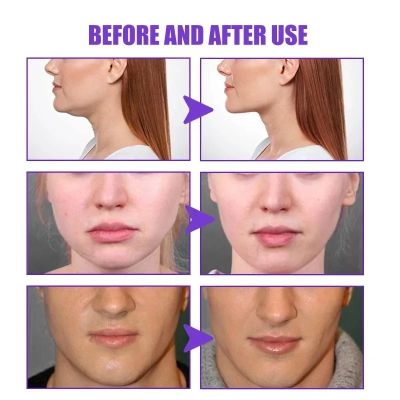 フェイスリフト痩身クリーム痩身引き締め V 字型除去咬筋二重 - Anti-Aging Face Cream のレビューと価格